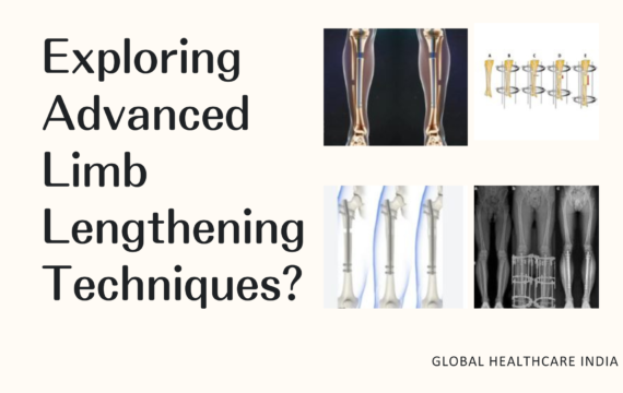 Exploring-Advanced-Limb-Lengthening-Techniques