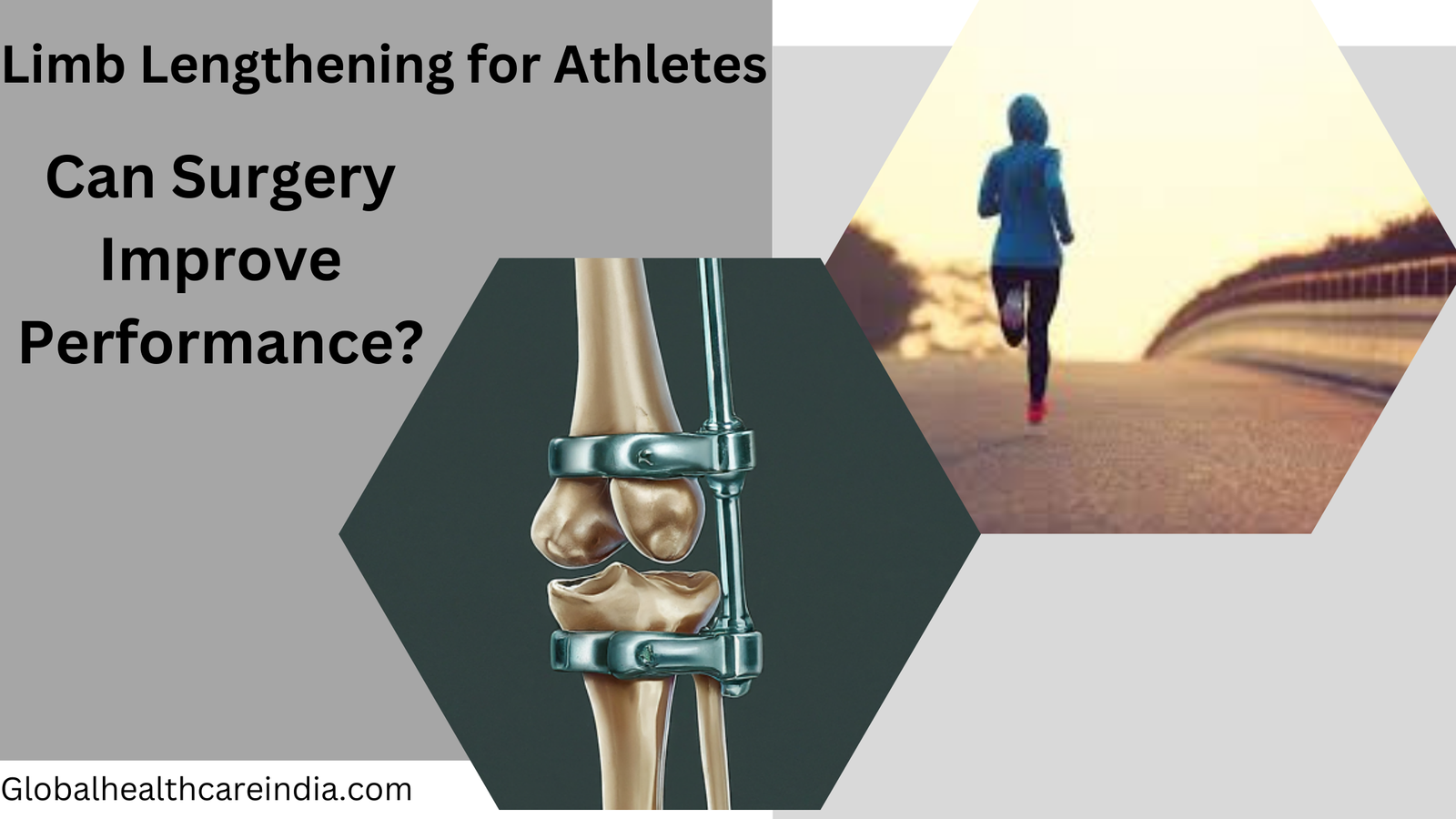 Limb Lengthening for Athletes Can Surgery Improve Performance