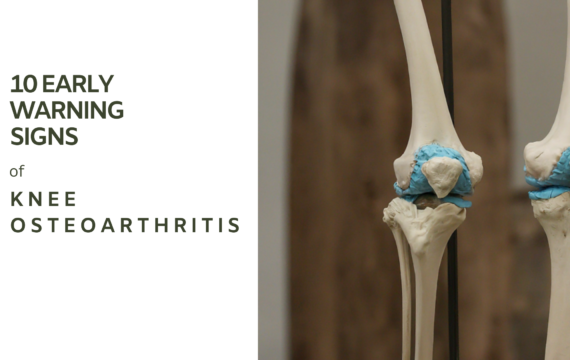 Knee osteoarthritis