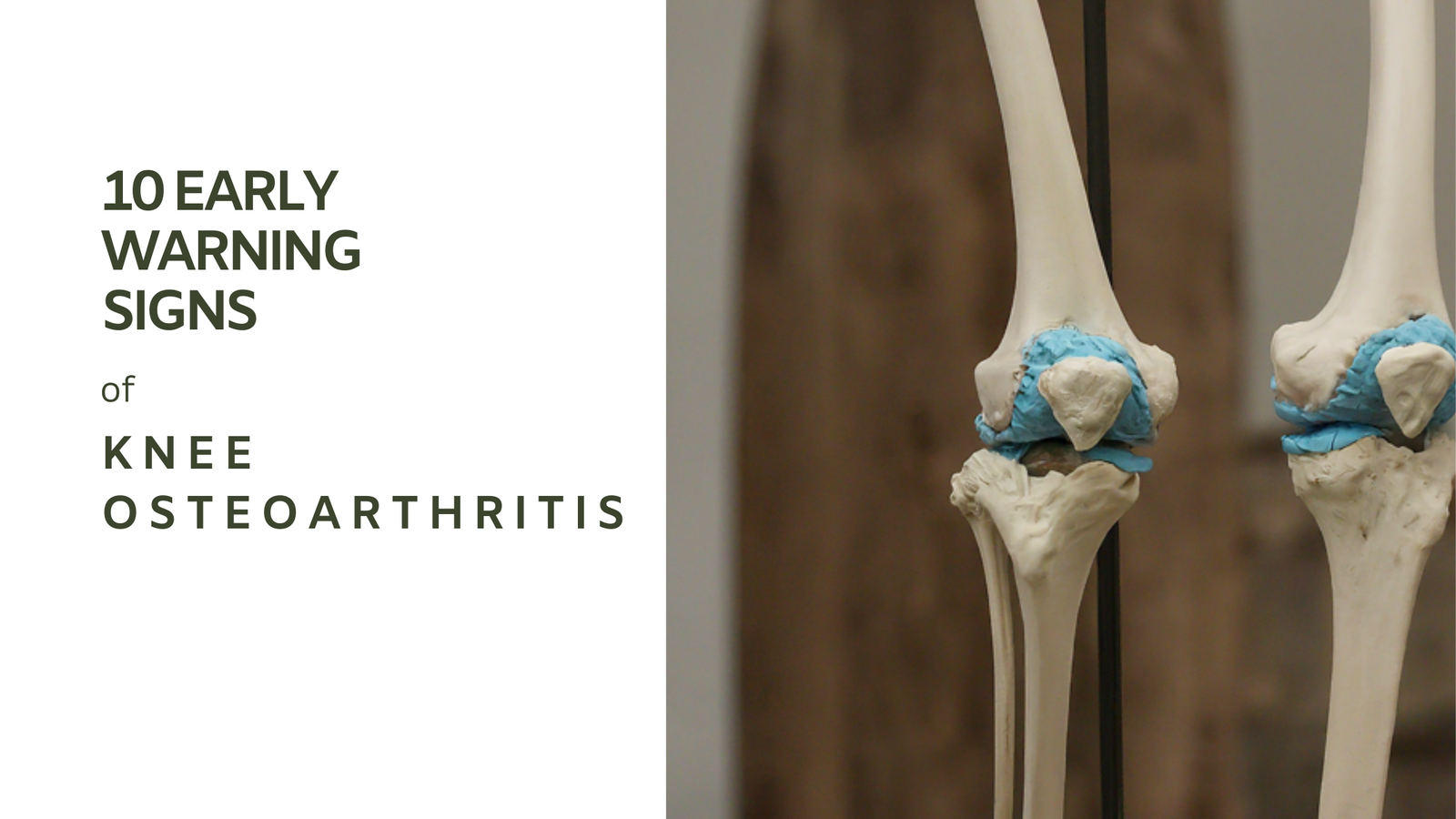 Knee osteoarthritis