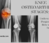 Knee Osteoarthritis Stages