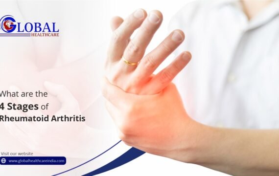 4 Stages of Rheumatoid Arthritis GHTC