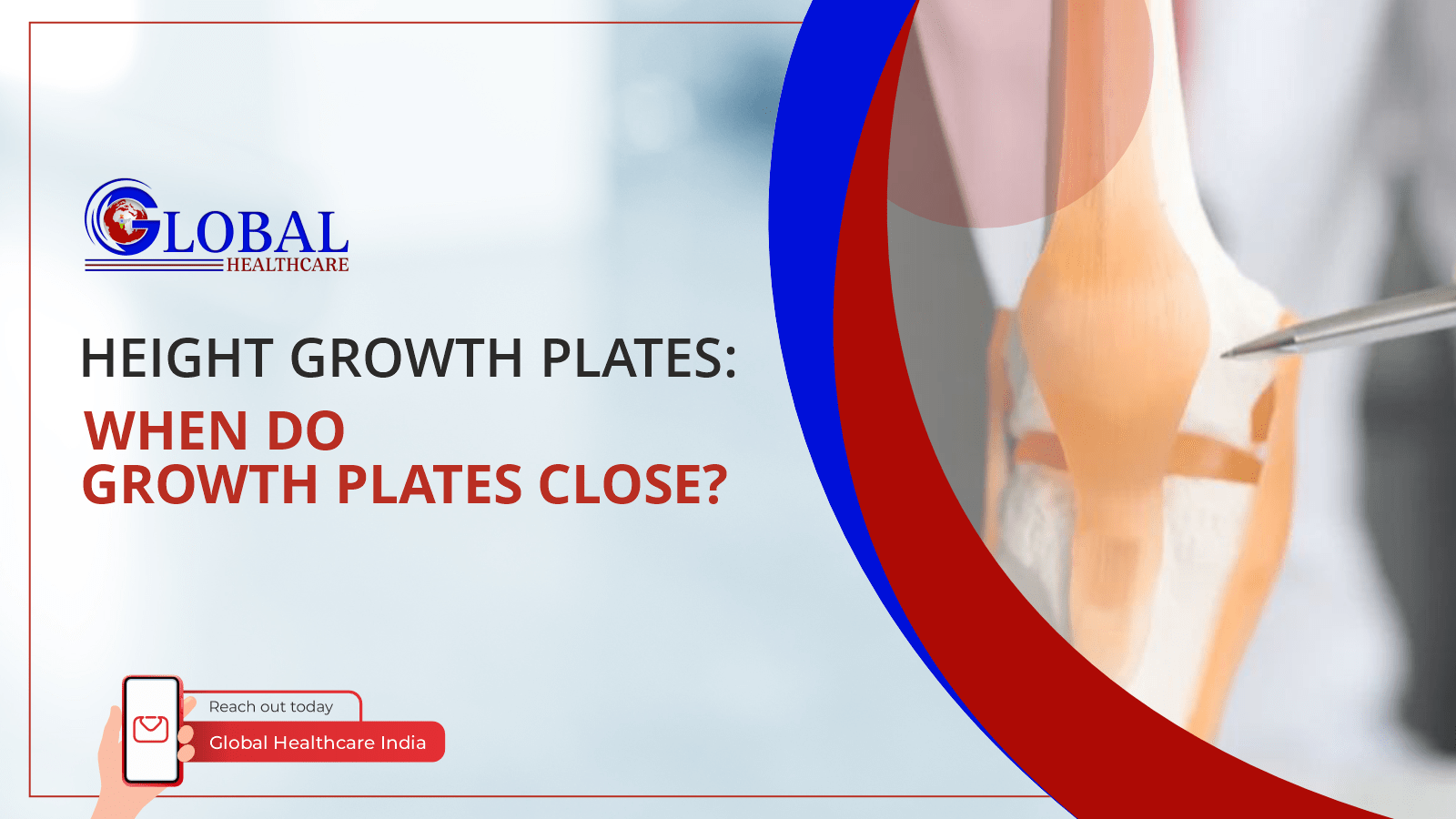 Height Growth Plates When Do Growth Plates Close