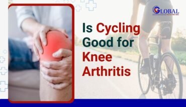 Is Cycling good for Arthritis