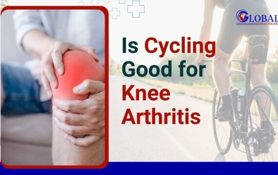 Is Cycling good for Arthritis