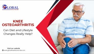 Knee Osteoarthritis: Can Diet and Lifestyle Changes Really Help?