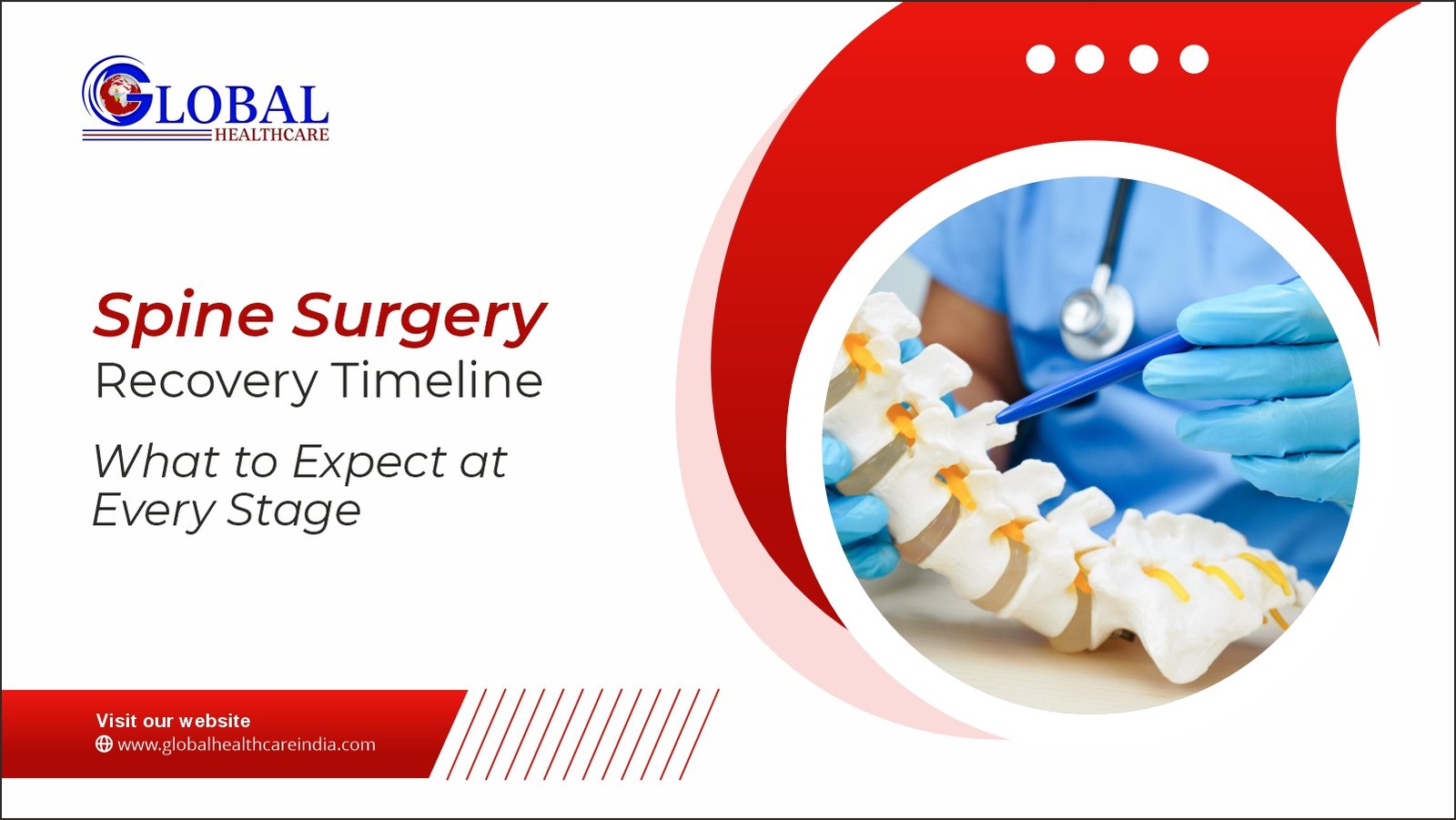 Spine Surgery Recovery Timeline: What to Expect at Every Stage