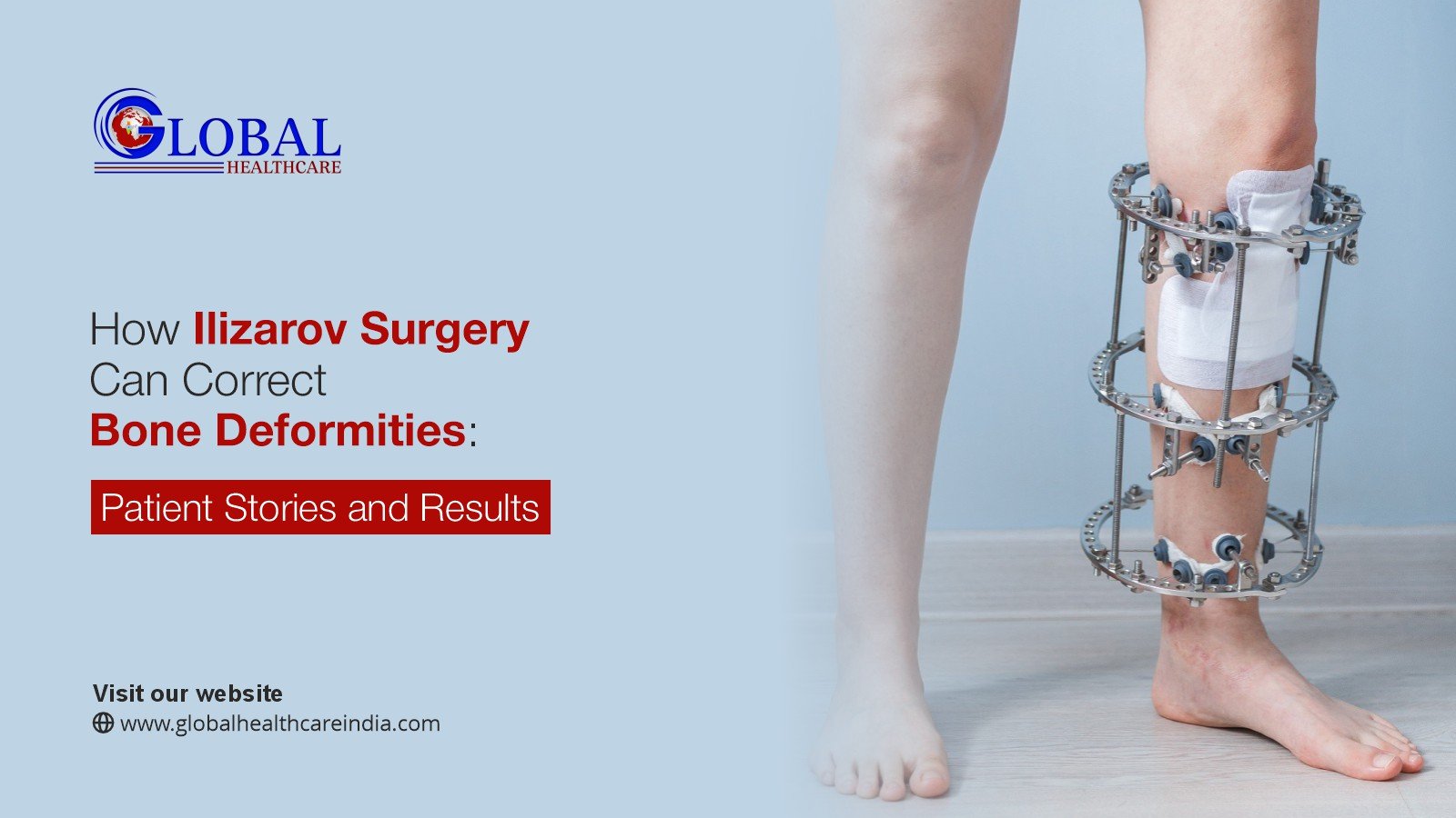 How Ilizarov Surgery Can Correct Bone Deformities