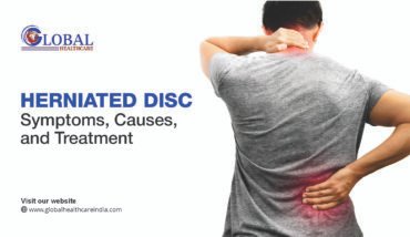 Herniated Disc: Symptoms, Causes, and Treatment